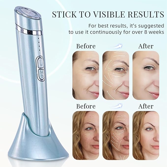 Micro-Vibration Eye & Face Massager – Dark Circle Reducer, Anti-Wrinkle, Skin Tightening & Lifting Device
