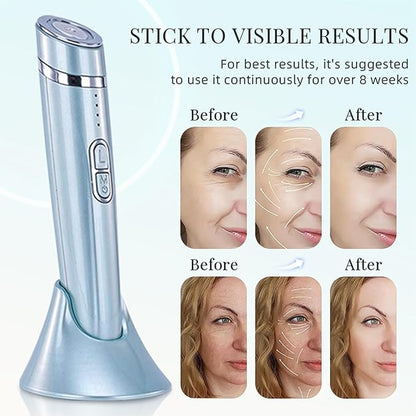 Micro-Vibration Eye & Face Massager – Dark Circle Reducer, Anti-Wrinkle, Skin Tightening & Lifting Device